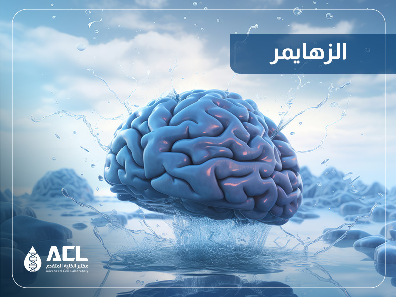 مرض الزهايمر | أسبابه وأعراضه وطرق التشخيص مع مختبر الخلية المتقدم
