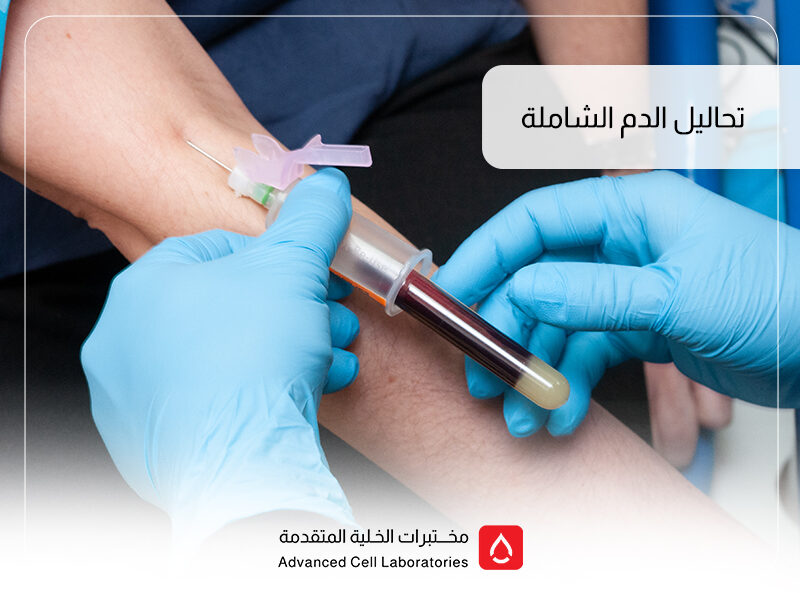 تحاليل الدم الشاملة في السعودية