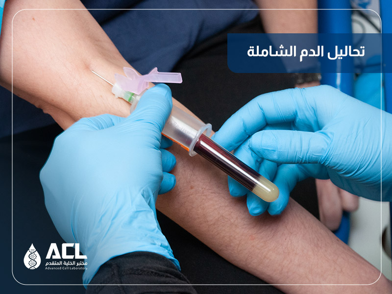 تحاليل الدم الشاملة