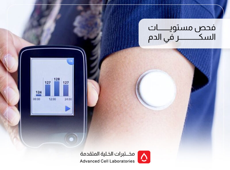 تحليل السكر التراكمي والدوري في السعودية