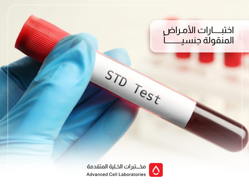 تحاليل الأمراض المنقولة جنسياً في السعودية