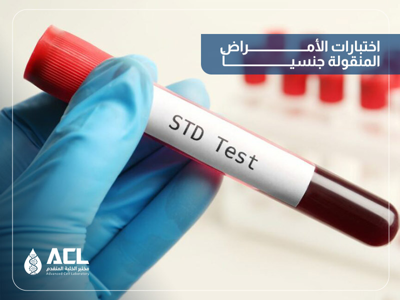 تحاليل الأمراض المنقولة جنسياً في السعودية