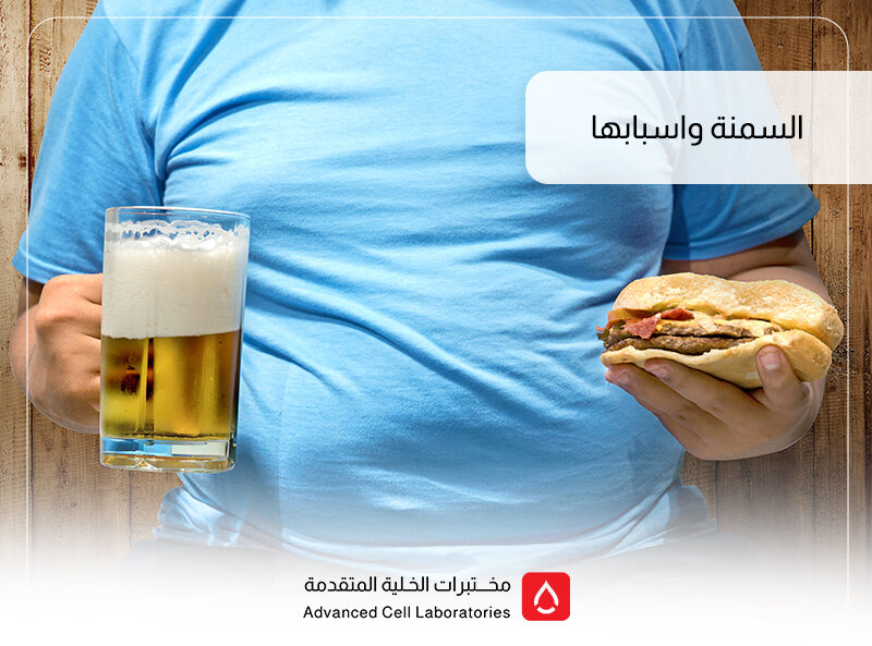 أسباب السمنة وعلاجها