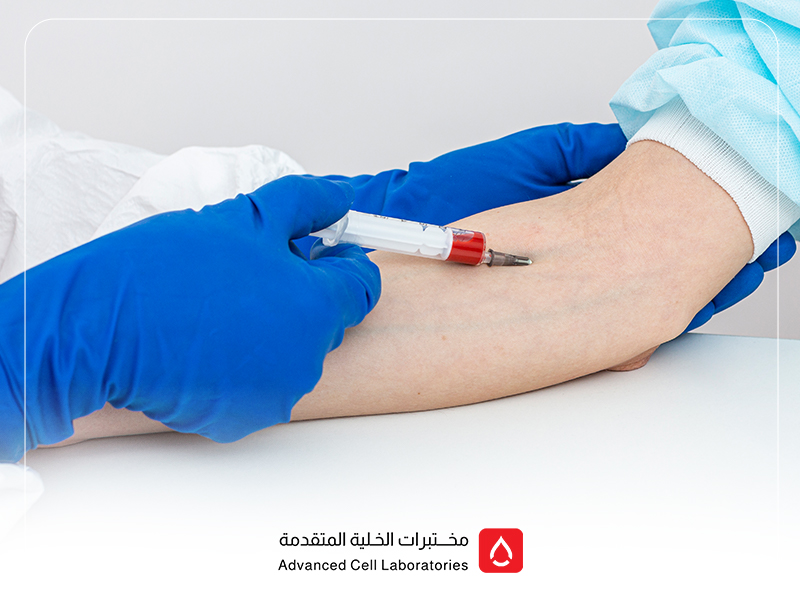 كيفية التحضير لتحليل الدم: دليلك الشامل لفحص دقيق وآمن