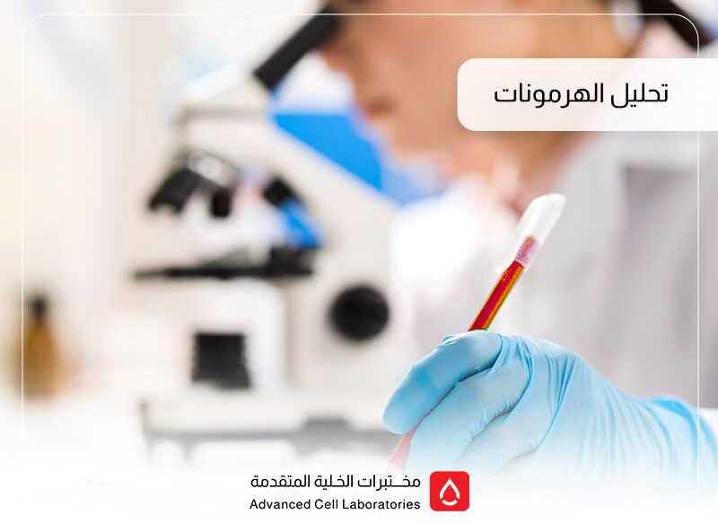 تحليل الهرمونات: دليلك الشامل لفحوصات الهرمونات في السعودية تحليل الهرمونات: دليلك الشامل لفحوصات الهرمونات في السعودية