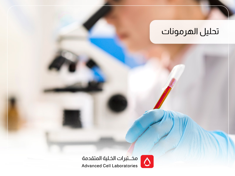 تحليل الهرمونات: دليلك الشامل لفحوصات الهرمونات في السعودية