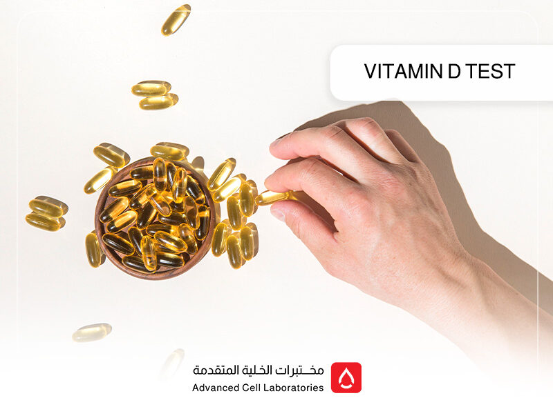 Vitamin D Test