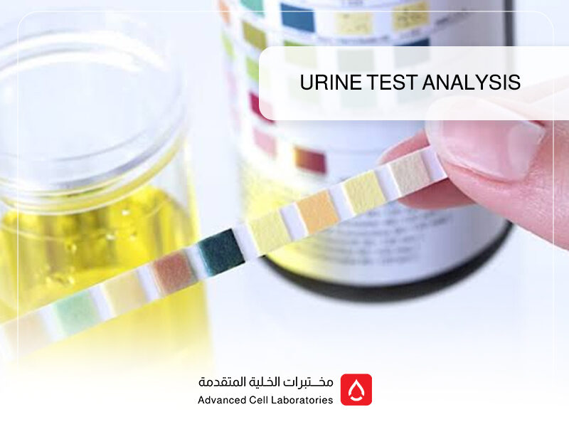 Urine Test Analysis 1 Urine Test Analysis